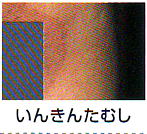 いんきんたむし